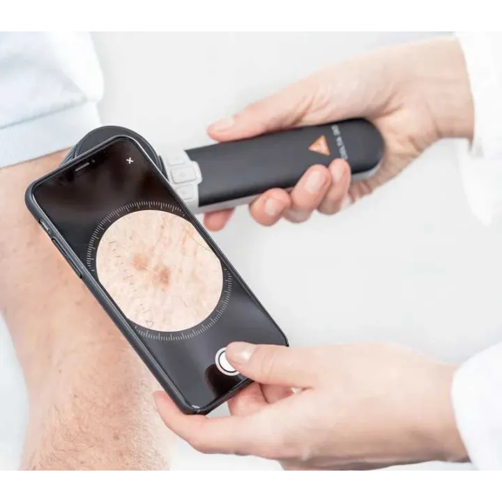 Dermatoscopio HEINE DELTA 30 con aplicación HEINE DERM