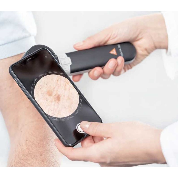 Dermatoscopio HEINE DELTA 30 con aplicación HEINE DERM