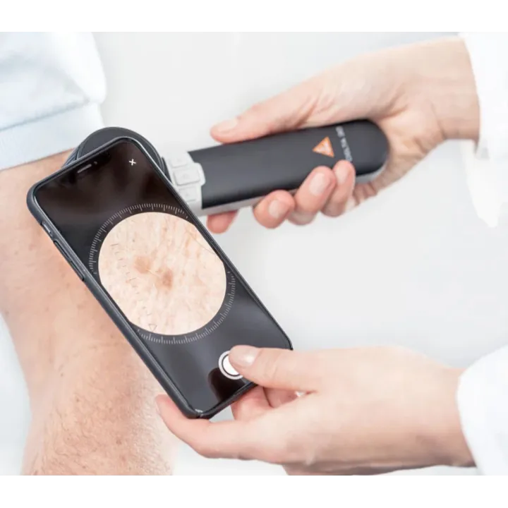 Dermatoscopio HEINE DELTA 30 PRO Set
